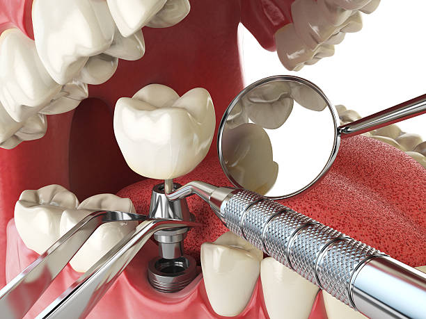 Best Emergency Treatment for Jaw Pain or Injury in Lake Shore, WA